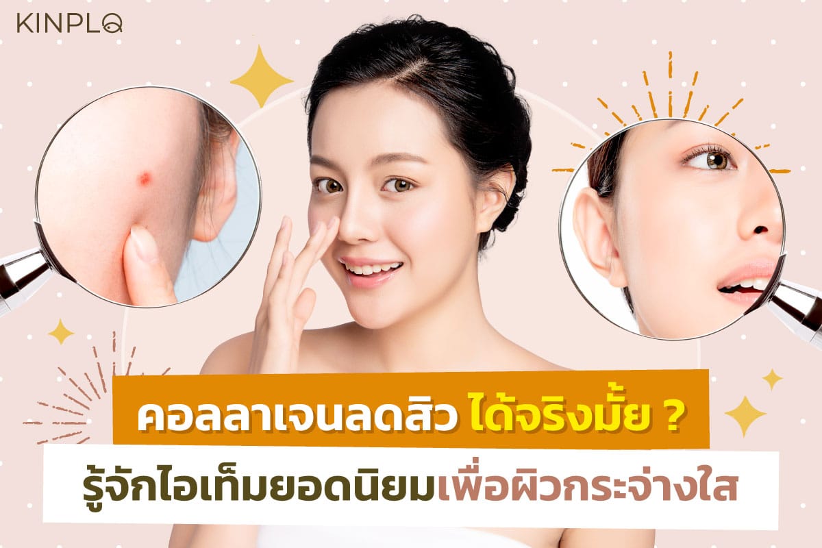 คอลลาเจนลดสิว