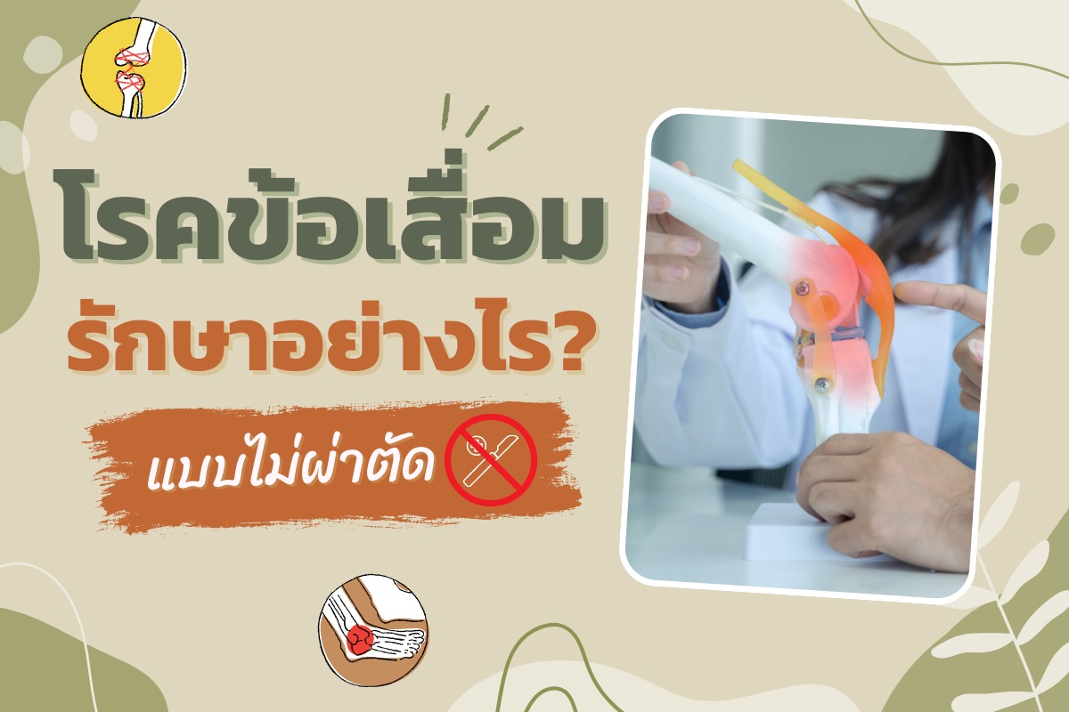 โรคข้อเสื่อมรักษาอย่างไร แบบไม่ผ่าตัด