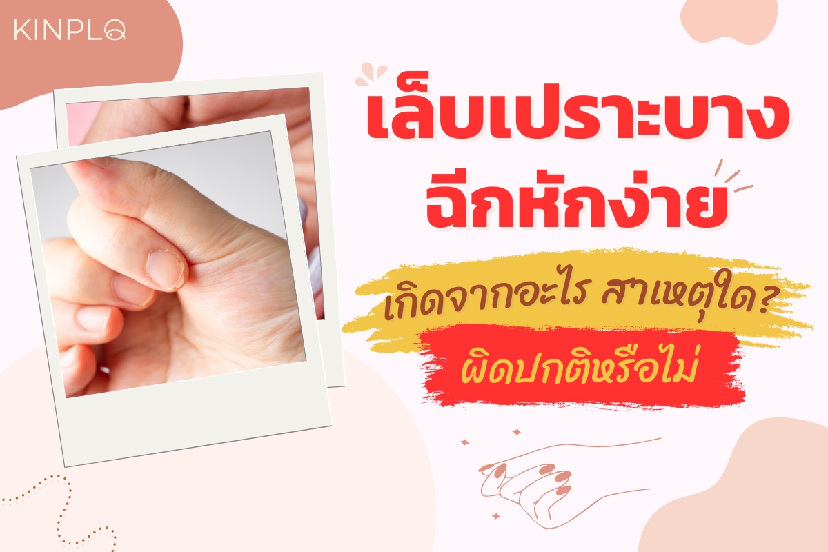 เล็บเปราะ ฉีกง่าย เกิดจากอะไร สาเหตุใด ผิดปกติหรือไม่ ?