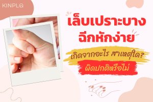 เล็บเปราะ ฉีกง่าย เกิดจากอะไร สาเหตุใด ผิดปกติหรือไม่ ?